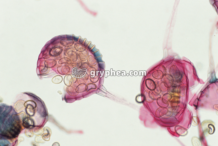 Polypode - Sporange avec spores x25 - gryphea.org
